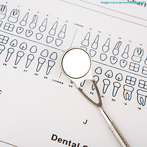 A metal dental mouth mirror resting on top of a printed teeth diagram chart, representing diagnostic oral examinations and check-ups.