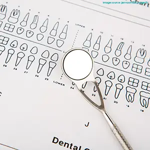A metal dental mouth mirror resting on top of a printed teeth diagram chart, representing diagnostic oral examinations and check-ups.