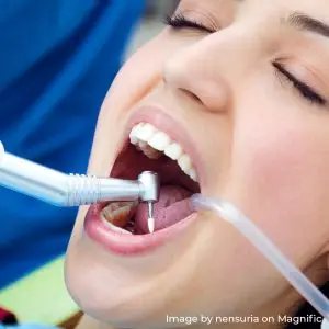 dentist using a mouth mirror during a routine oral examination, representing the initial consultation stage for root canal treatment.