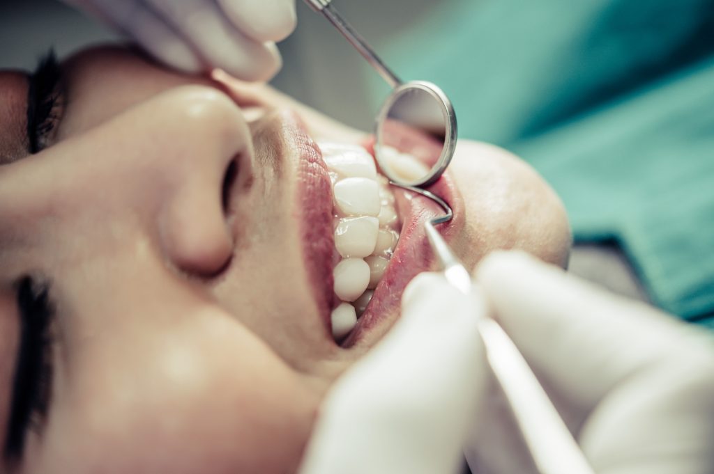 Endodontics (Root Canal)