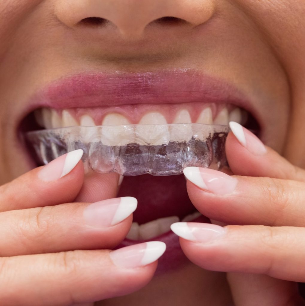 Orthodontics